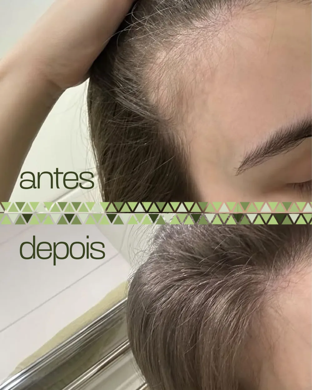 Antes e depois das entradas e da linha frontal, com o antes acima e o depois abaixo.