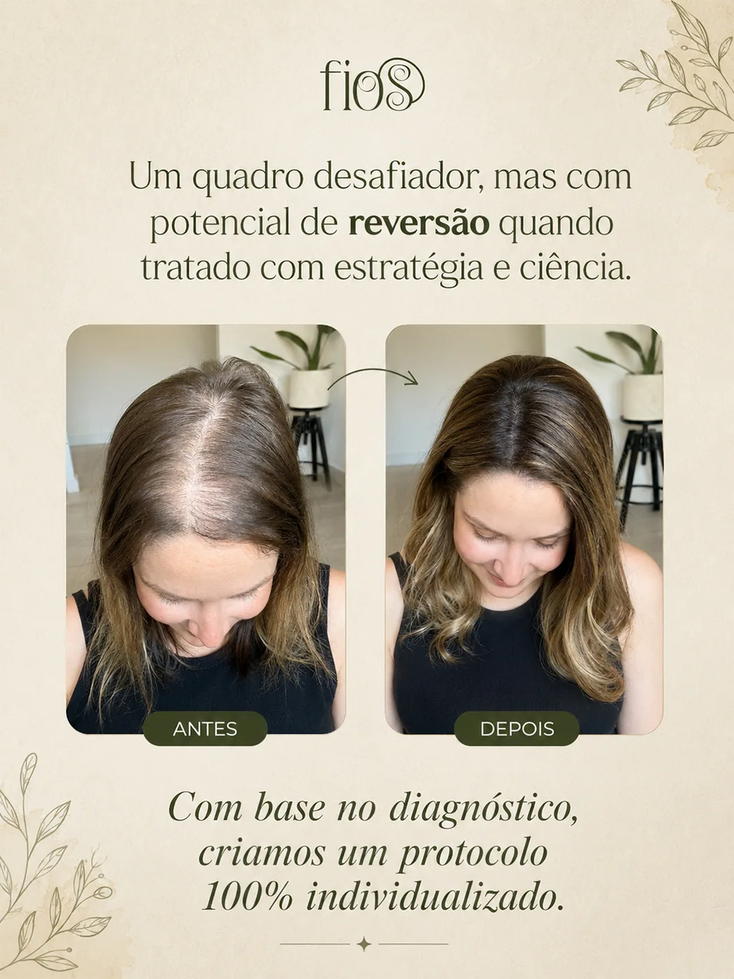 Comparação antes e depois do couro cabeludo de uma mulher, mostrando melhora na densidade capilar.